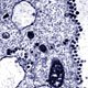 04-16who-sars-virus.jpg